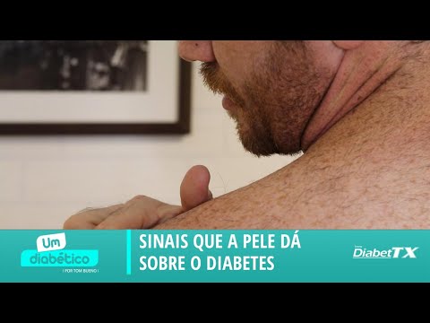 SINAIS QUE A PELE DÁ SOBRE O DIABETES | Tom Bueno