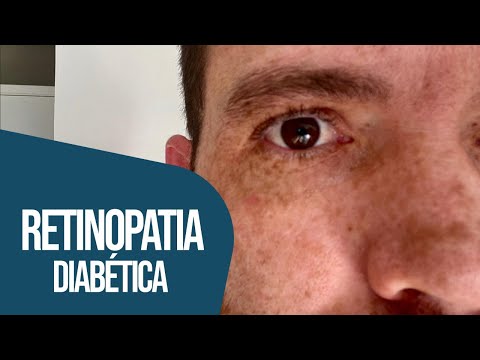 RETINOPATIA DIABÉTICA: UMA AMEAÇA À VISÃO