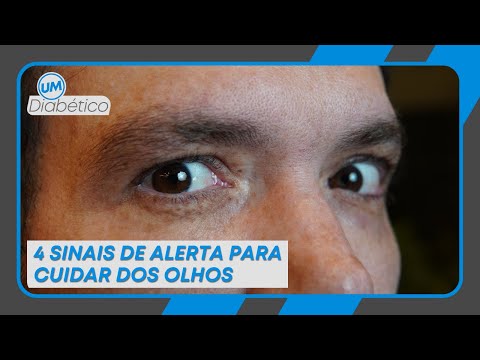 4 SINAIS DE ALERTA PARA CUIDAR DOS OLHOS | Tom Bueno