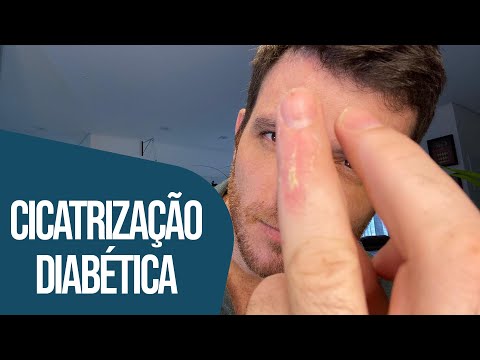 CICATRIZAÇÃO DIABÉTICA: O QUE ELA PODE REVELAR?
