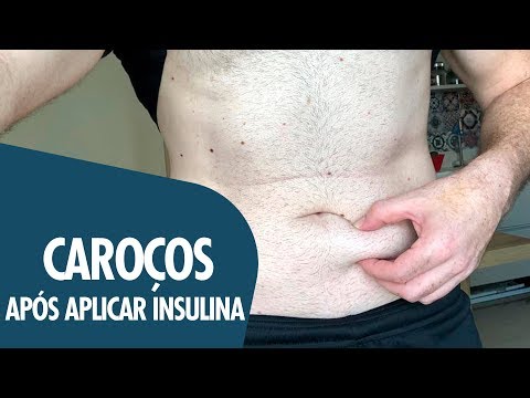 APLIQUEI INSULINA E APARECERAM CAROÇOS NA MINHA BARRIGA!