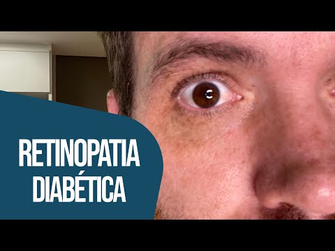 RETINOPATIA DIABÉTICA TEM CURA? | Tom Bueno