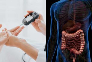 Substância para tratamento de intestino pode ajudar a evitar diabetes tipo 2