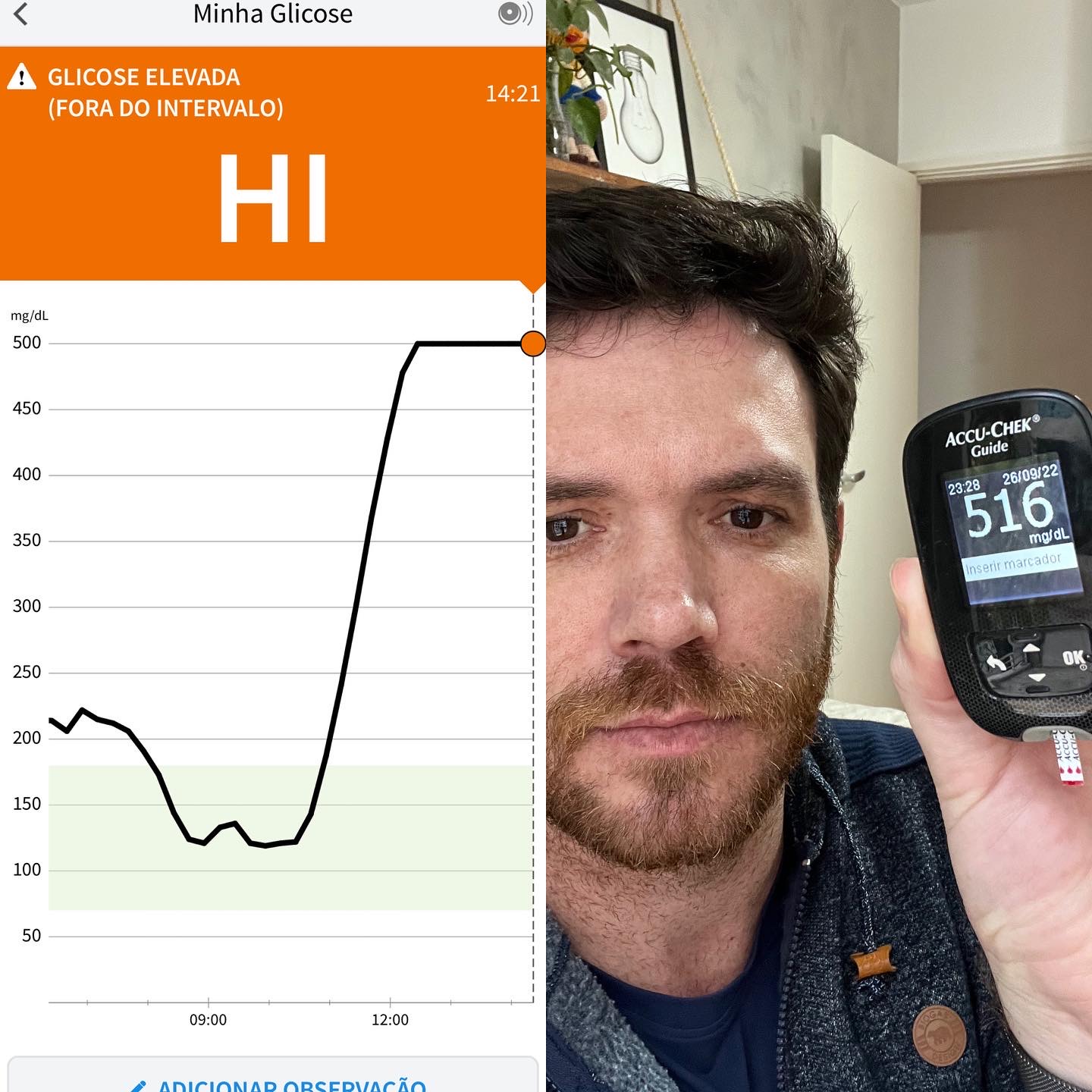 Imagem da glicose alta acima de 500