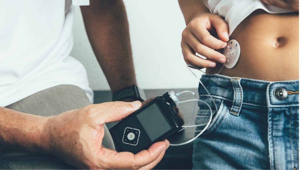 Imagem mostra duas pessoas manuseando uma bomba de insulina.