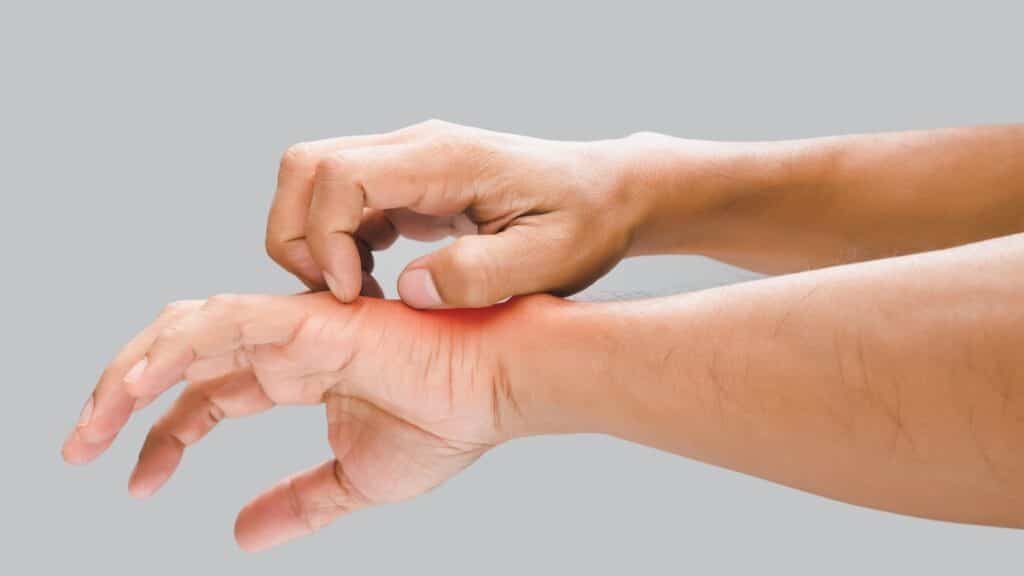 Coceira pode estar ligada diretamente à falta de controle do diabetes.