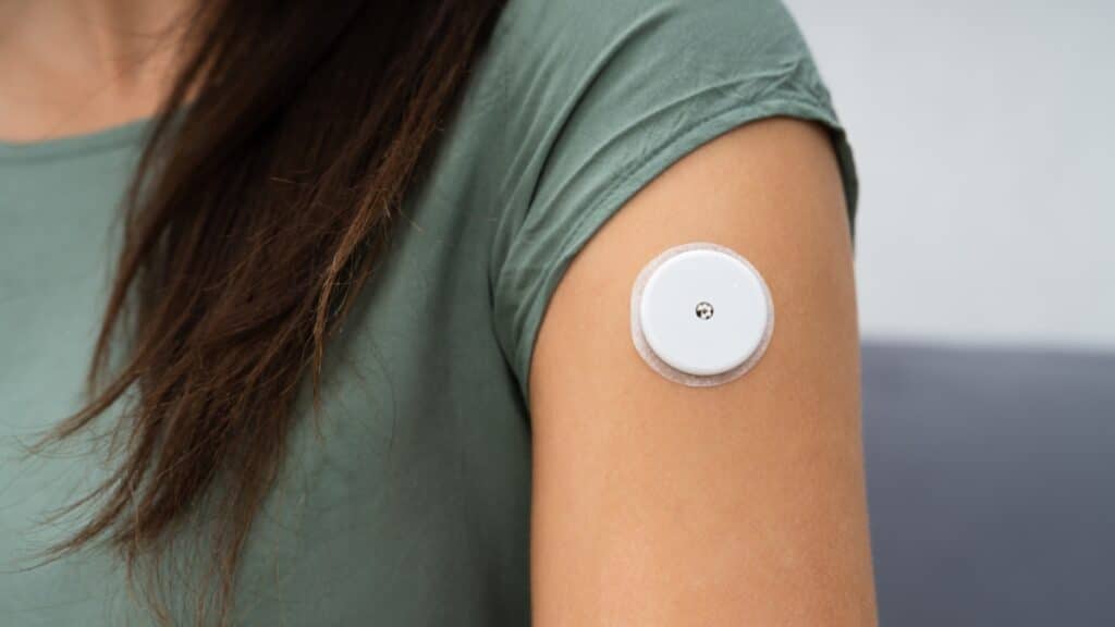 A Câmara Municipal de Ribeirão Preto, no interior de São Paulo, aprovou, por unanimidade, um projeto de lei que garante o fornecimento de sensor de glicose e aparelho digital para crianças e adolescentes com diabetes tipo 1 atendidos pelo Sistema Único de Saúde (SUS).
