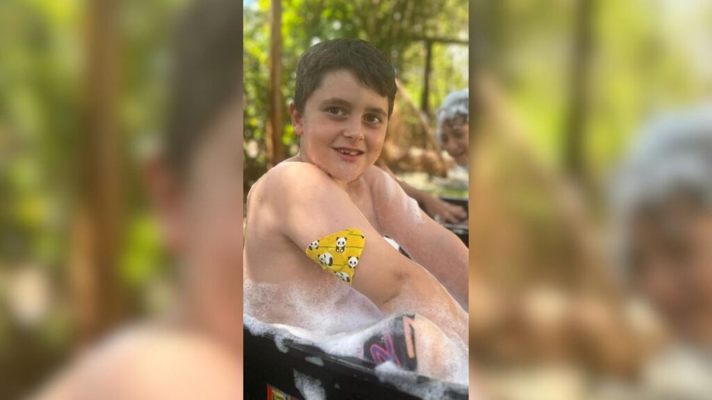 Criança com diabetes tipo 1 fica sem insulina por um período nos primeiros meses após o diagnóstico; saúde da família se transforma com a descoberta da doença 3 Criança após o diagnóstico de diabetes tipo 1