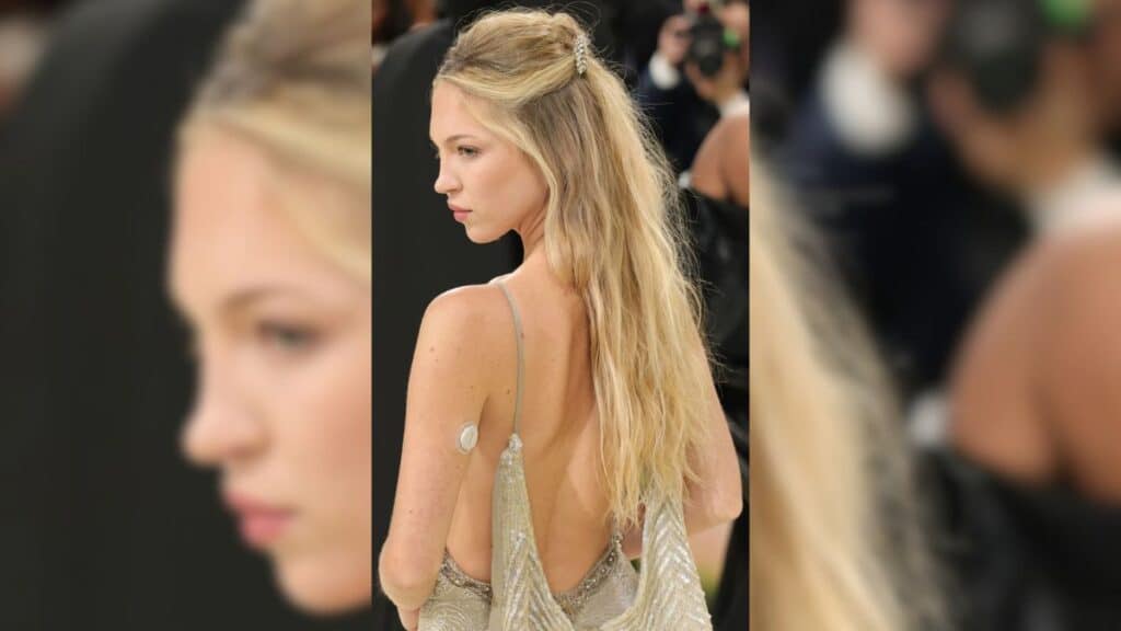 Lila Moss no Met Gala com sensor de glicose para monitorar seu diabetes tipo 1