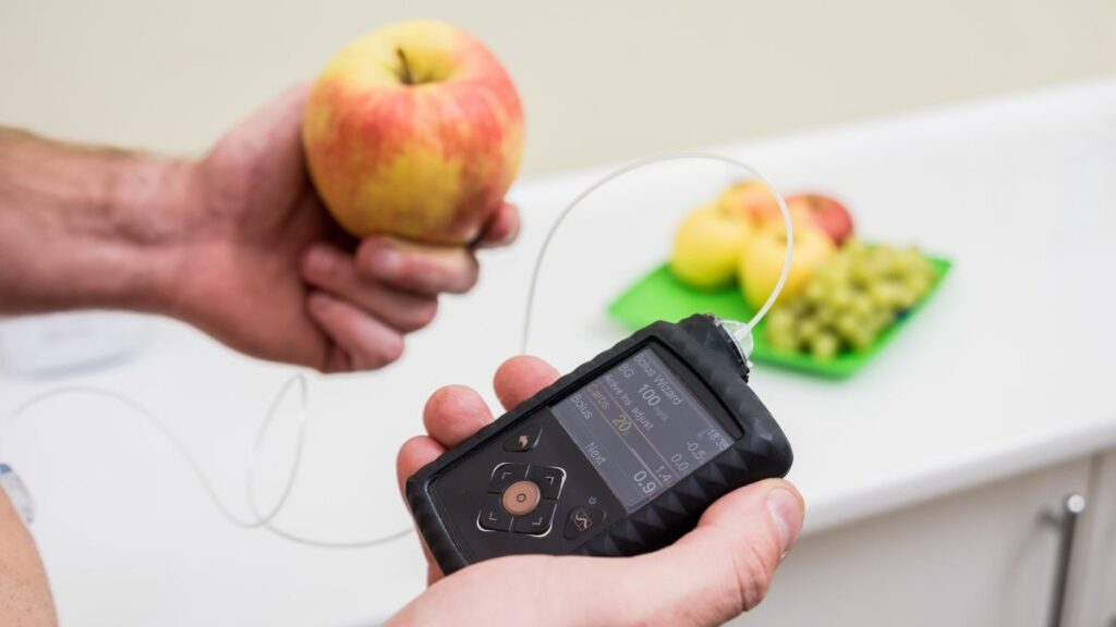 Bomba de insulina pode mudar o tratamento de algumas pessoas com diabetes tipo 2, diz médico 1 bomba de insulina diabetes tipo 2