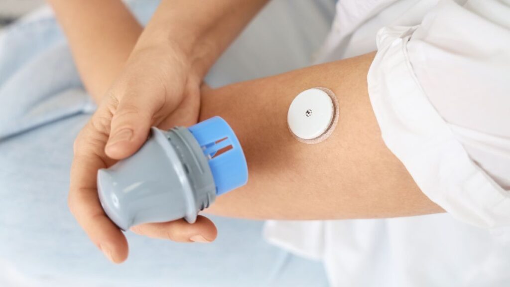 Barroso (MG) começa a distribuir sensor de glicose para crianças e adolescentes com diabetes tipo 1; veja quem tem direito sensor de glicose pra pessoas com diabetes em barrosos