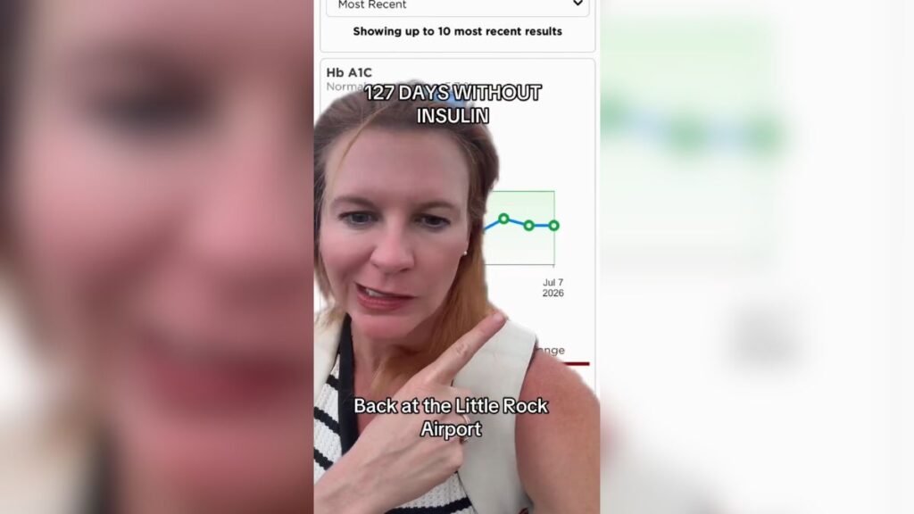 Mulher fica mais de 125 dias sem insulina e revela hemoglobina glicada após transplante experimental diabetes katie