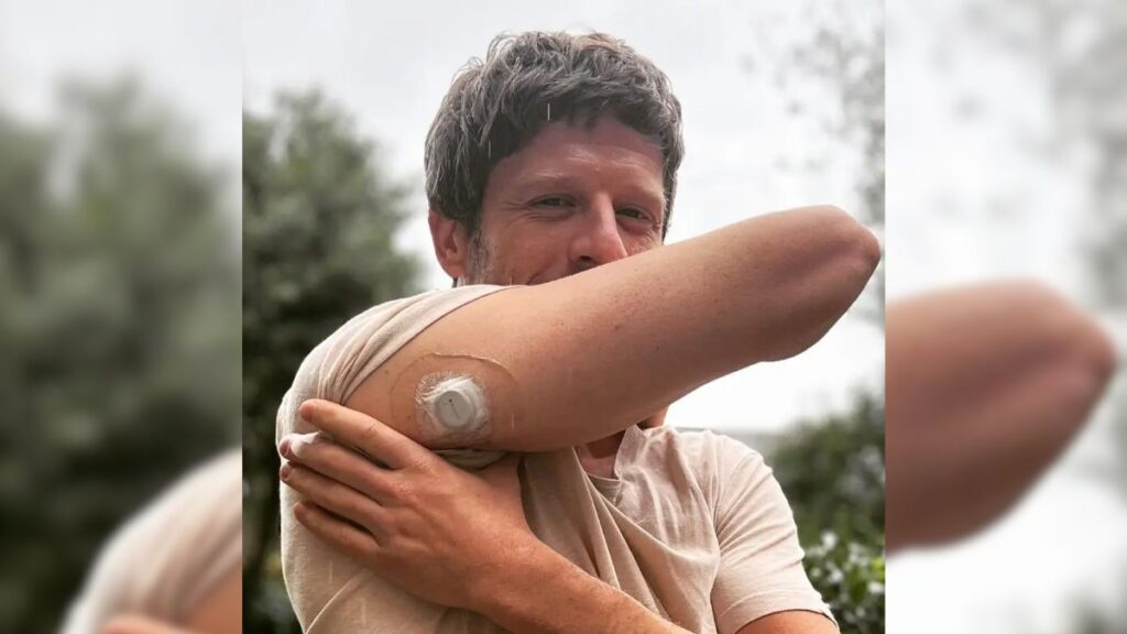 James Norton, ator da série 'House of the Dragon', sonhava que estava com sede antes de descobrir o diabetes tipo 1 aos 22 anos; conheça a história 2 diabetes sensor
