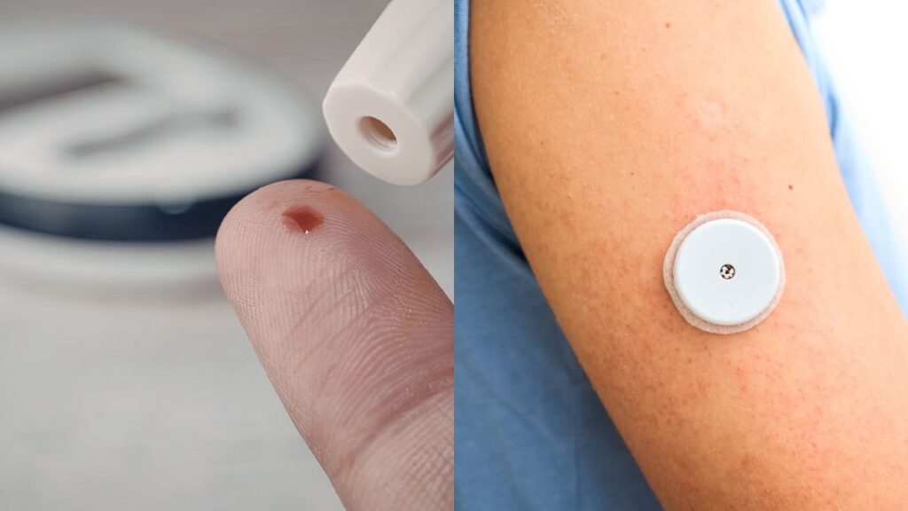 Sensor ou ponta de dedo? Enfermeiras explicam quando cada um é mais indicado para quem tem diabetes diabetes