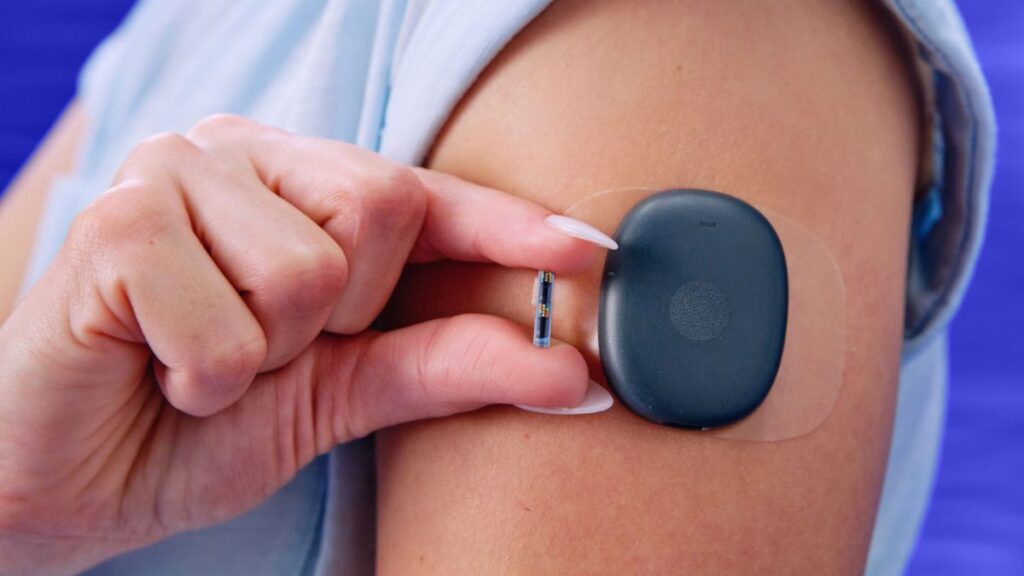 Entenda como funciona o sensor de glicose que fica dentro da pele por 1 ano 2 sensor de glicose que dura 1 ano