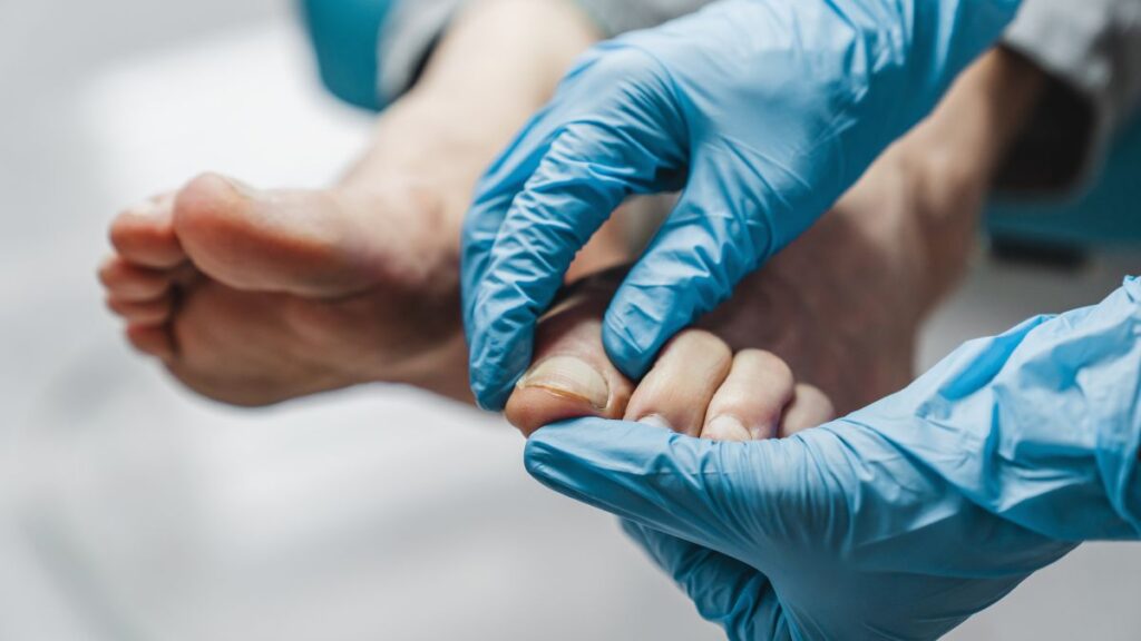 Diabetes tipo 2: por que os pés devem ser avaliados uma vez por ano? Especialistas explicam diabetes e pés