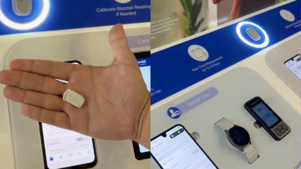 Nova opção de sensor de glicose apresentada na EASD 2026 pode chegar ao Brasil nos próximos anos; veja como funciona Sensor de glicose para monitoramento da glicemia