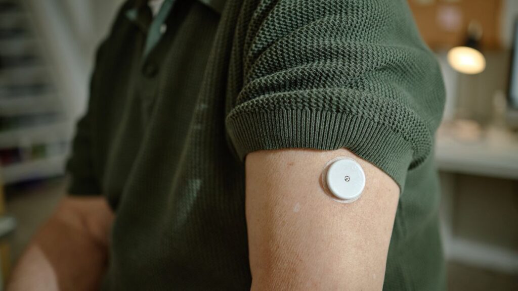 Por que o sensor de glicose ainda não está disponível para todos com diabetes no SUS? Entenda o que diz especialista sensor de glicose sus