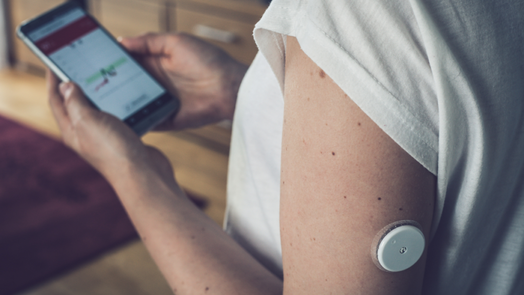 Sensor de glicose no SUS: por que o acesso ainda depende dos municípios? Pessoa usando sensor de glicose no braço e monitorando a glicemia pelo celular