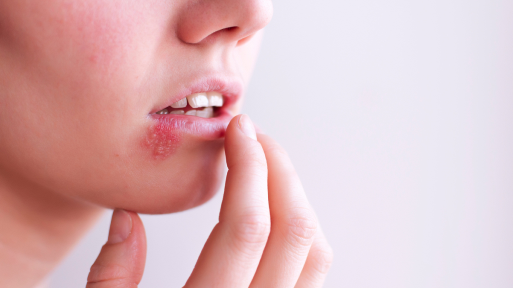 Tem diabetes e o herpes vive voltando? Entenda o que investigar Herpes recorrente em pessoas com diabetes